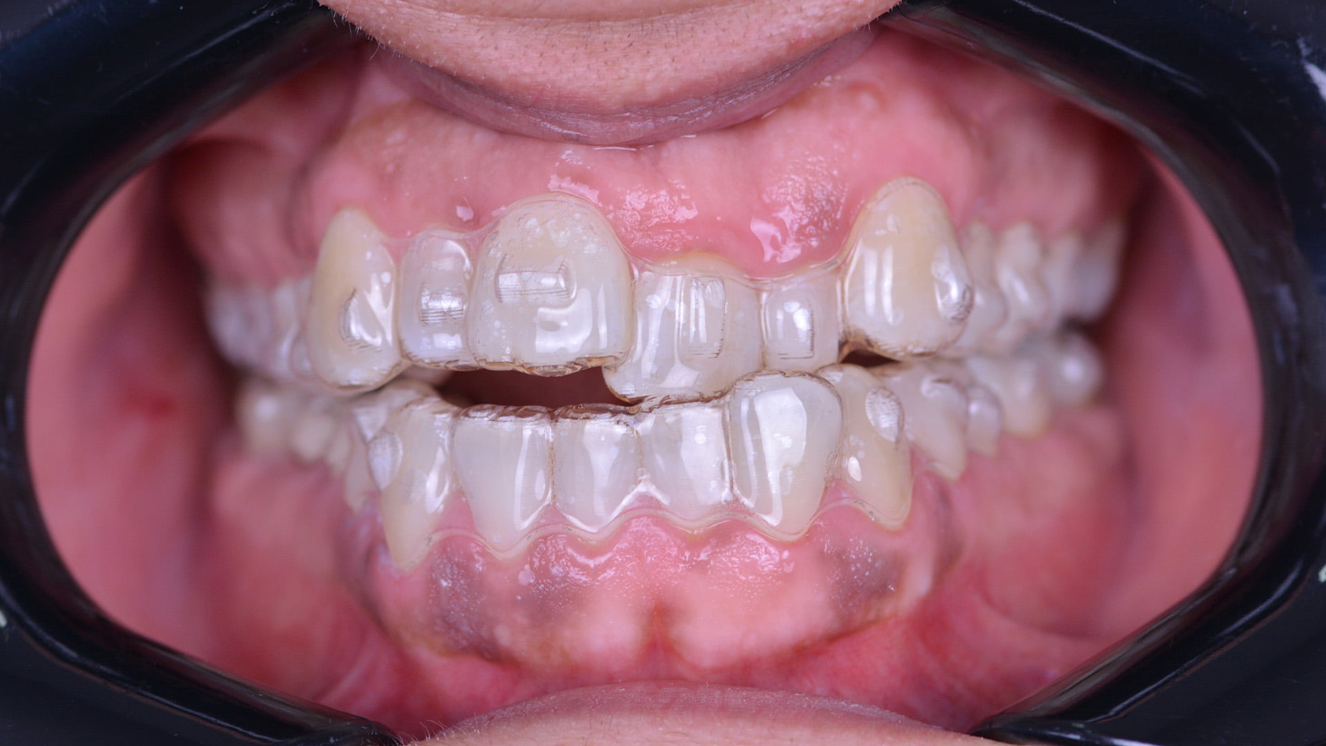 https://www.dentakgul.com/wp-content/uploads/2023/06/ortodonti-1.jpg